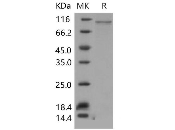Mouse AGO2/Argonaute 2/EIF2C2 Recombinant Protein (His Tag) (RPES0312)