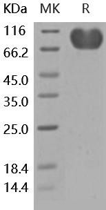 Human CD155/PVR Recombinant Protein (RPES0355)