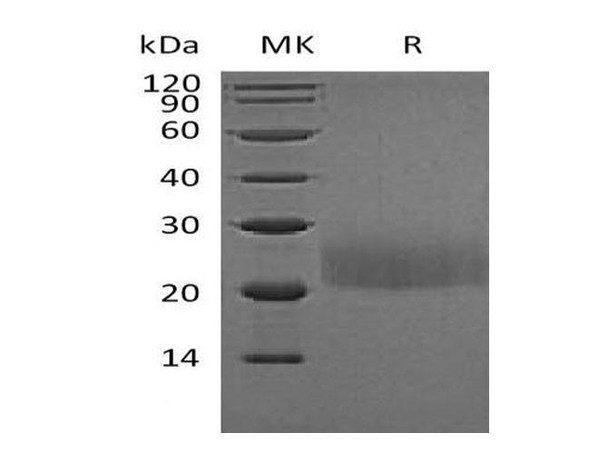 Mouse CTLA4 Recombinant Protein (RPES0361)