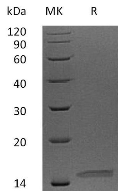 Human Neurturin/NRTN Recombinant Protein (RPES0395)