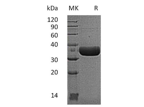 Mouse MCPT6 Recombinant Protein (RPES0402)