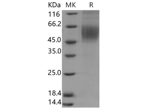 Human CDCP1/CD318 Recombinant Protein (aa 1-343, His Tag) (RPES0404)