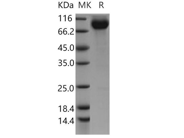 Human CDCP1/CD318 Recombinant Protein (Fc Tag) (RPES0424)