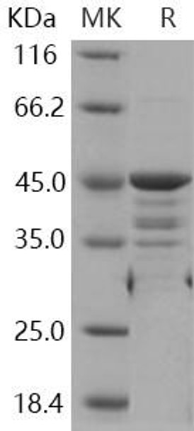 Human WTAP Recombinant Protein (GST Tag) (RPES0431)
