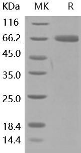 Human PD-L1/B7-H1/CD274 Recombinant Protein (RPES0432)