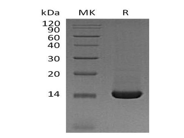 Mouse Trefoil Factor 2/TFF2 Recombinant Protein (RPES0442)