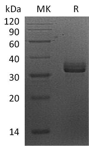 Human Syntaxin-7/STX7 Recombinant Protein (RPES0455)