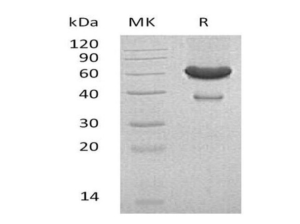 Mouse Ephrin-A1/EFNA1 Recombinant Protein (RPES0457)