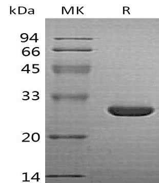 Human HO/HMOX1 Recombinant Protein (RPES0471)