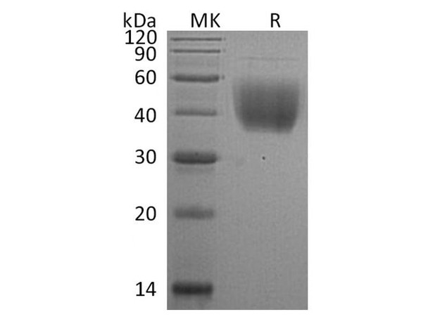 Rat CD80/B7 Recombinant Protein (RPES0474)