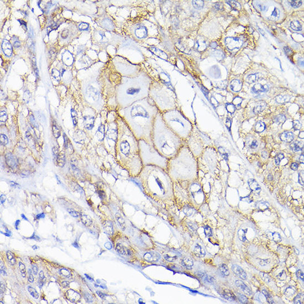 Anti-SEMA4F Antibody (CAB10432)