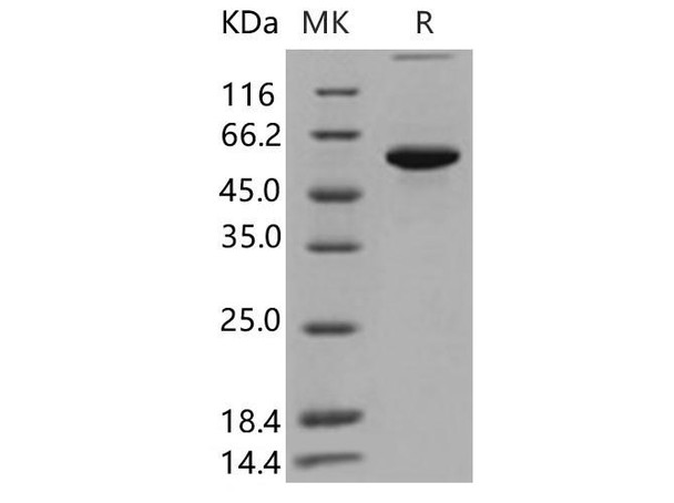 Human P4HB Recombinant Protein (His Tag) (Active) (RPES0560)
