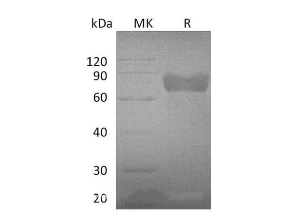 Mouse GHR Recombinant Protein (RPES0573)