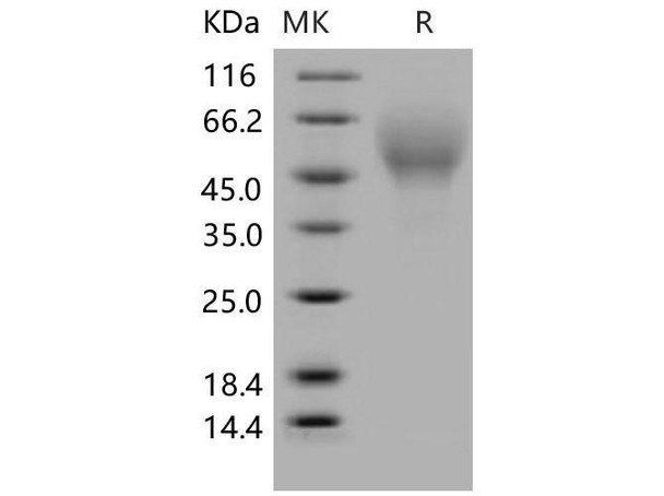 Mouse CD200R4/CD200RLa Recombinant Protein (His Tag) (RPES0601)