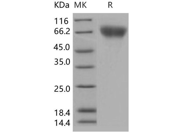 Human FGFR2/CD332 Recombinant Protein (His Tag) (Active) (RPES0617)