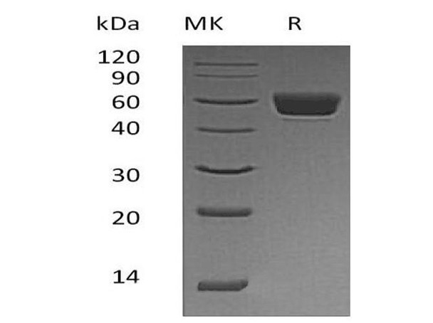 Mouse Serpin A3N Recombinant Protein (RPES0653)