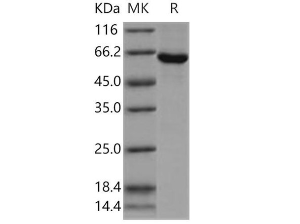 Human SPHK1/Sphingosine Kinase 1 Recombinant Protein (His&GST Tag) (RPES0654)