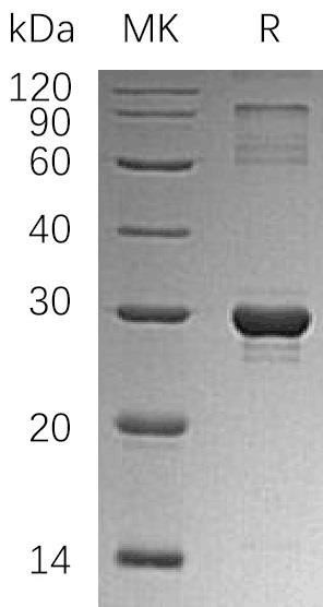 Human HGPRT/HPRT1 Recombinant Protein (RPES0700)