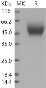Human CD111/Nectin Recombinant Protein (His Tag) (Active) (RPES0710)