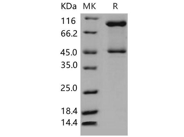 Mouse SerpinB3/SCCA1 Recombinant Protein (His Tag) (RPES0714)