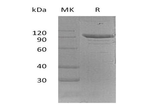 Mouse PSGL/CD162 Recombinant Protein (RPES0724)