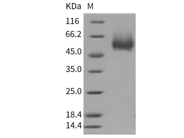 Mouse CD4/LEU3 Recombinant Protein (His Tag) (Active) (RPES0737)