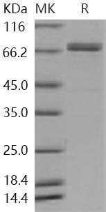 Human LRRN3 Recombinant Protein (His Tag) (RPES0744)