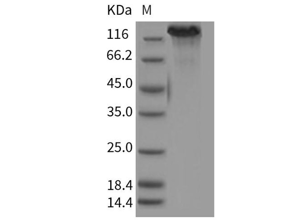 Mouse CHL Recombinant Protein (His Tag) (RPES0773)