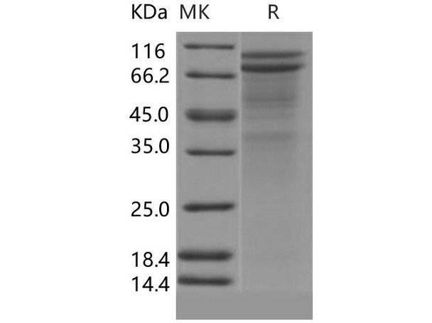 Human DSC2/Desmocollin-2 Recombinant Protein (His Tag) (RPES0781)