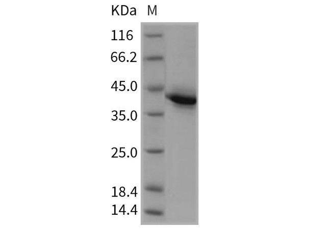 Rat TNFRSF17/BCMA Recombinant Protein (Fc Tag) (RPES0801)