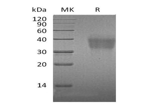 Mouse PD/PDCD1 Recombinant Protein (RPES0814)