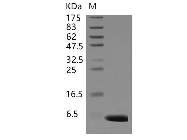 Human S100A1 Recombinant Protein  (RPES0819)