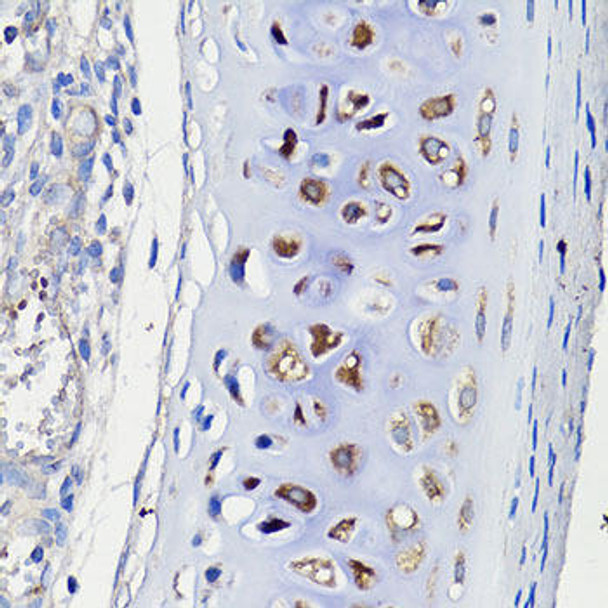 Anti-COMP Antibody (CAB13963)