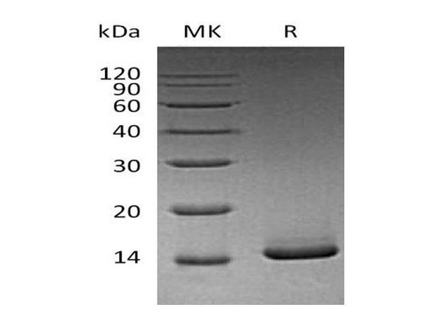 Mouse GM-CSF/CSF2 Recombinant Protein (Active) (RPES0902)