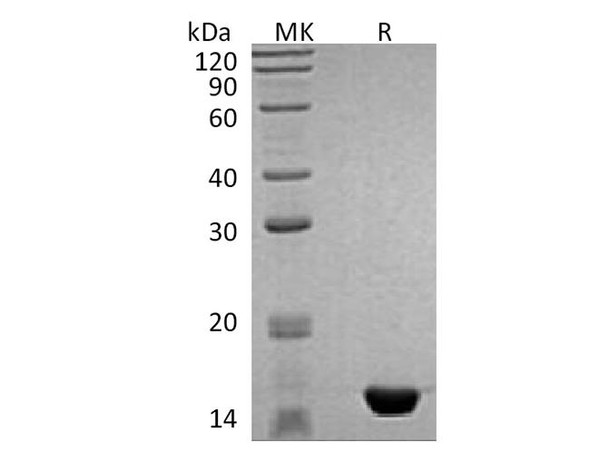 Human MAP1LC3B Recombinant Protein (RPES0941)
