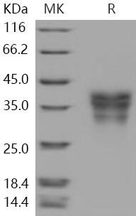 Human EDAR/DL Recombinant Protein (RPES0963)