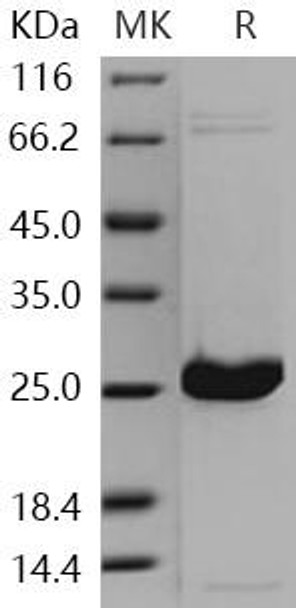 Human UCHL1/PGP9.5 Recombinant Protein (His Tag) (Active) (RPES1003)