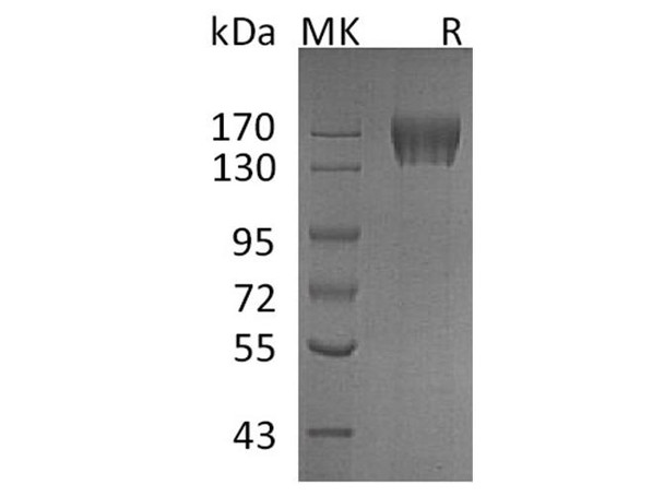 Human c-KIT/CD117 Recombinant Protein (RPES1013)