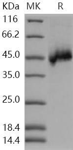 Human NETO1/BTCL1 Recombinant Protein (His Tag) (RPES1032)