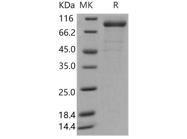 Human Interleukin-35/IL-35 Recombinant Protein (Fc Tag) (Active) (RPES1037)