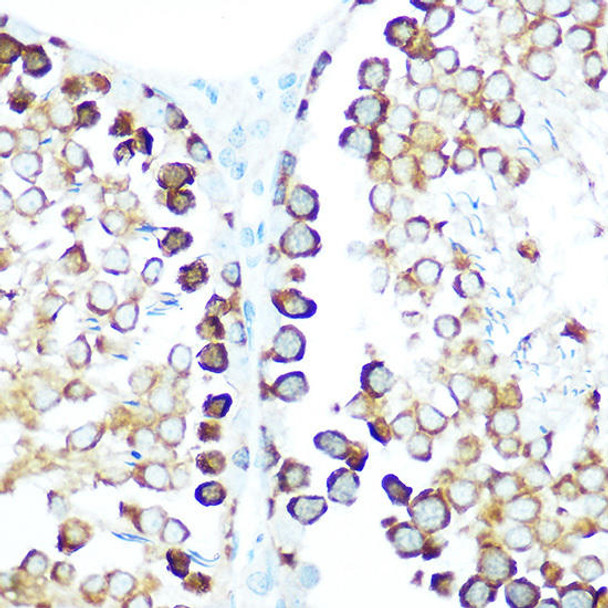 Anti-STIP1 Antibody (CAB14106)