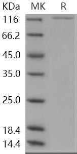 Human MAP4K5/MEKKK5 Recombinant Protein (His & GST Tag) (RPES1104)