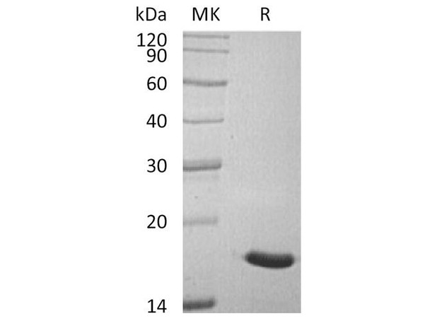 Human ACP1/LMW-PTP Recombinant Protein (RPES1121)