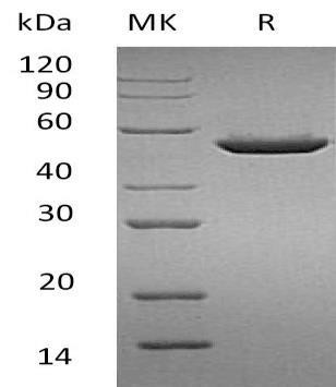 Human PNLIPRP1/PLRP1 Recombinant Protein (RPES1134)