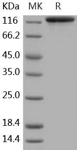 Human EGFR/ErbB1 Recombinant Protein (RPES1169)