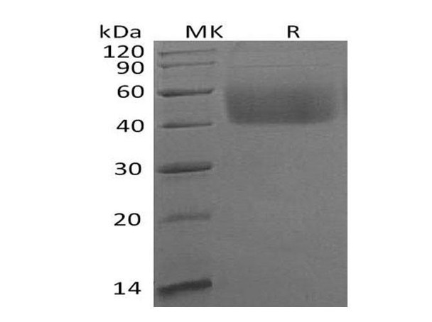 Human B7-H6 Recombinant Protein (RPES1177)