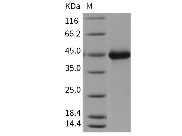 Mouse Wnt Inhibitory Factor 1/WIF1 Recombinant Protein (His Tag) (RPES1192)