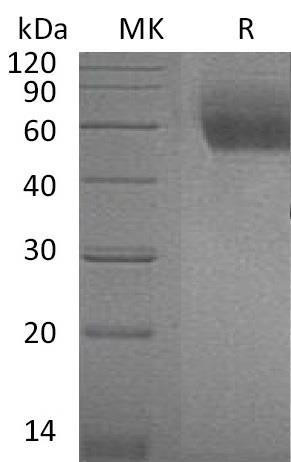 Mouse IL1RL1/ST2 Recombinant Protein (RPES1211)