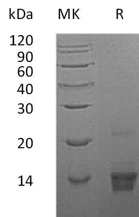 Parathyroid Hormone/PTH Recombinant Protein (RPES1224)