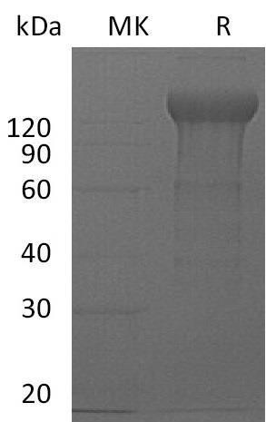 Mouse IL12RB2/IL12R-beta 2 Recombinant Protein (RPES1243)